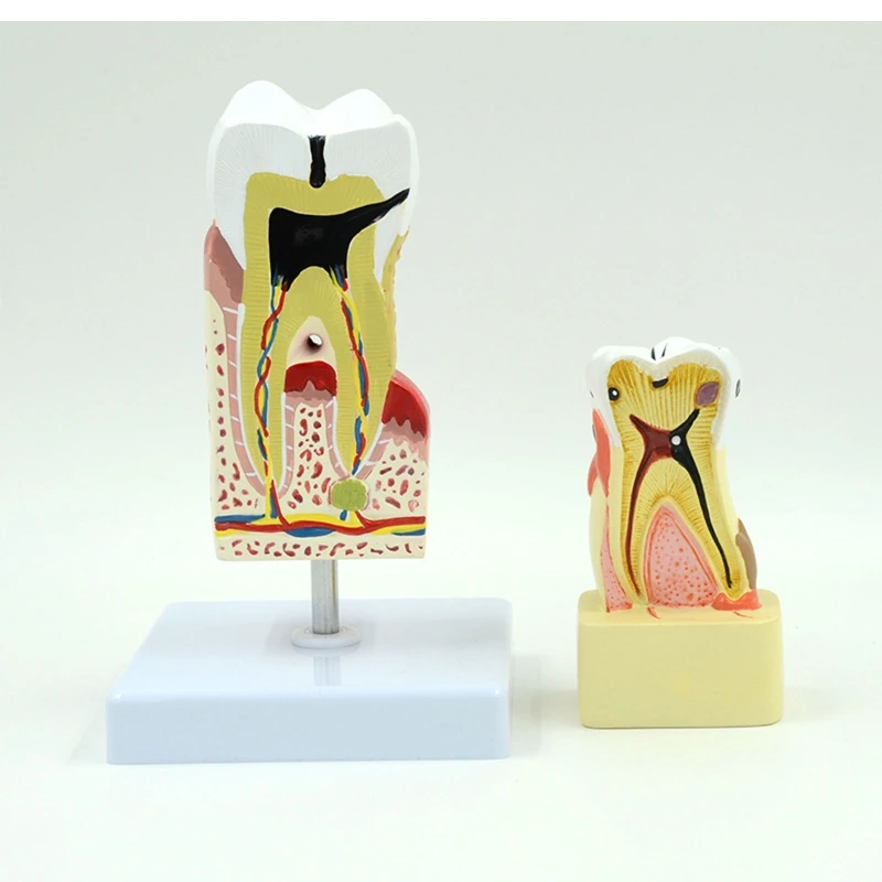 Dental Teeth Periodontal Model Analysis Pathology Model Dental Teaching Research Model for Dentist Studens Study H8WD