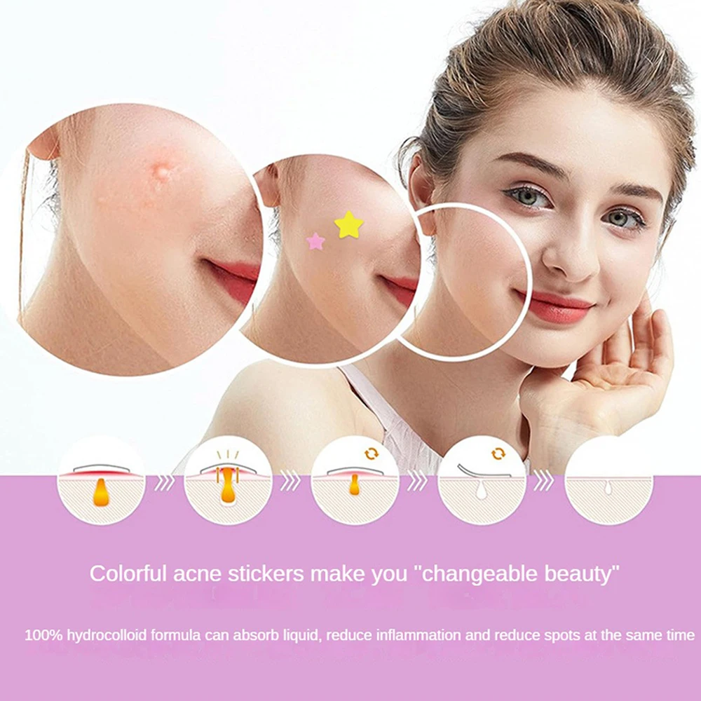 Love Heart-shaped Color Pimple Stickers Waterproof Anti-acne Hydrocolloid Absorbing Acne-removing Skin Care