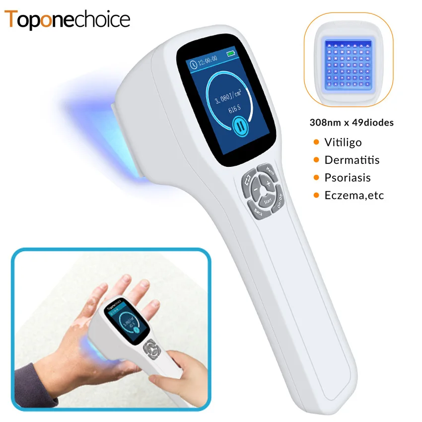 49 Diodes 308nm Excimer Phototherapy Instrument for Skin Disorders 308nm UVB Light Therapy for Vitiligo Psoriasis Eczema