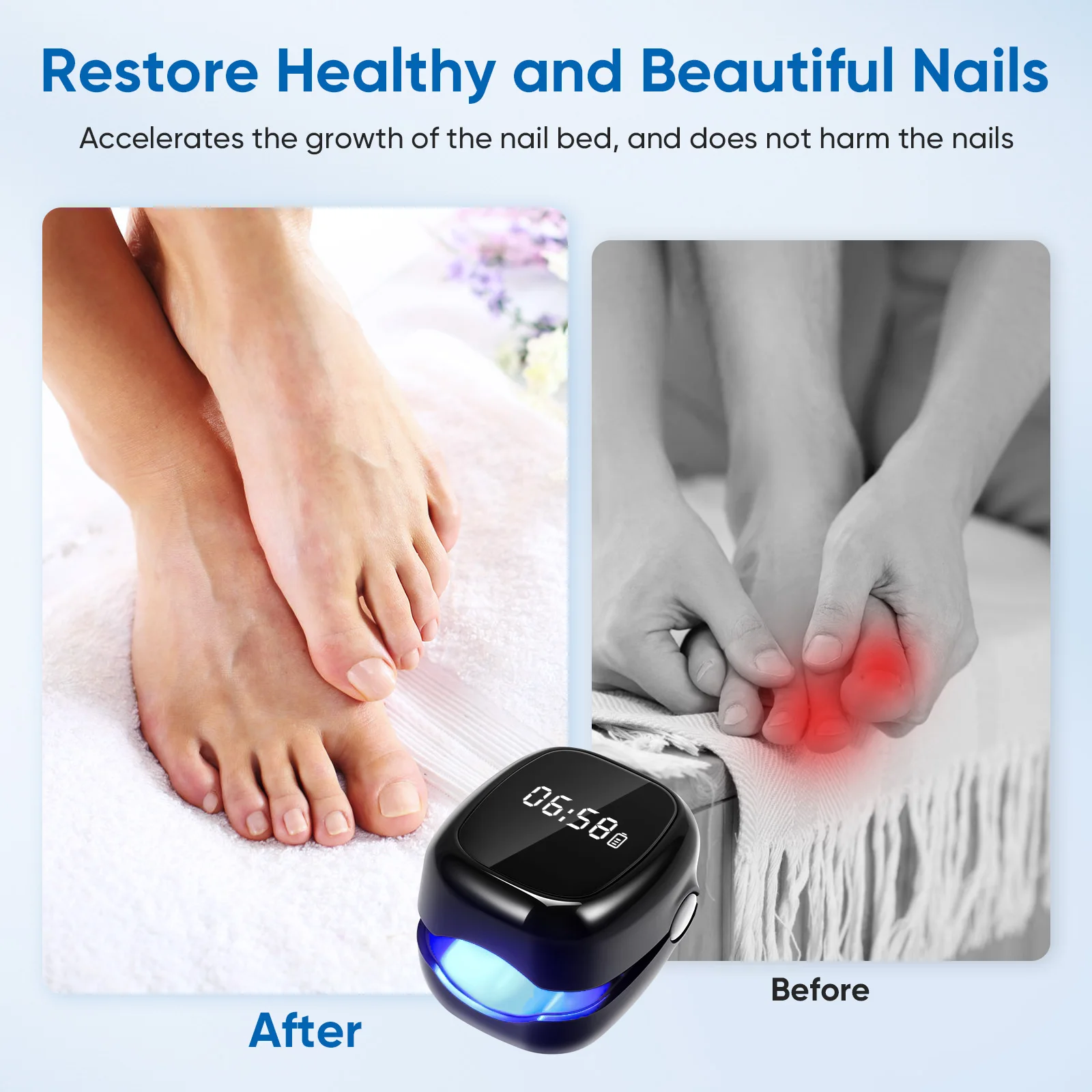 Zwarte Schimmel Nagel Laser Apparaat Reparatie Nagels Schimmel Onychomycose Nagel Schimmel Reiniging Laser Apparaat Voet Nagelverzorging Gereedschap