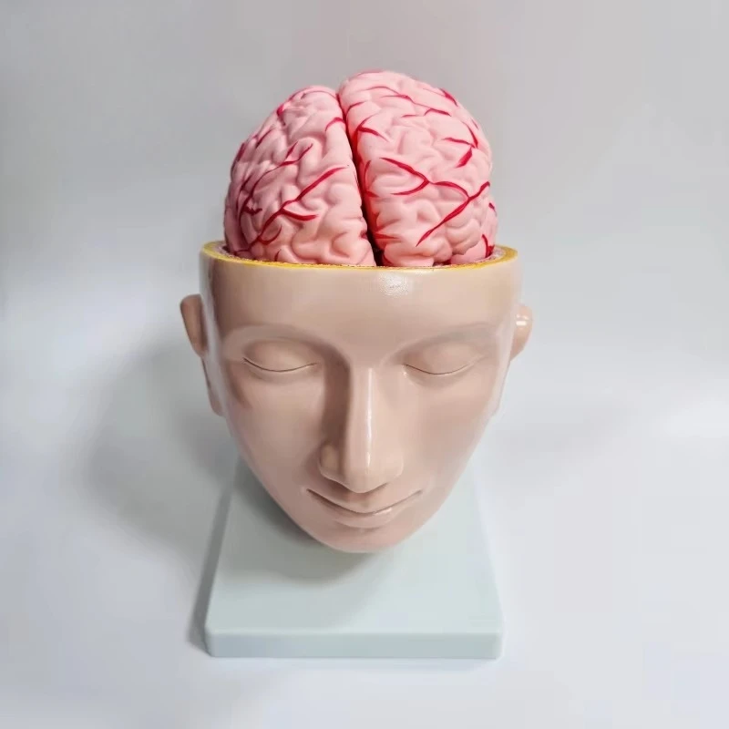 

Anatomical Model of the Cerebral Arteries Attached to the Human Head - Medical Teaching Training Model