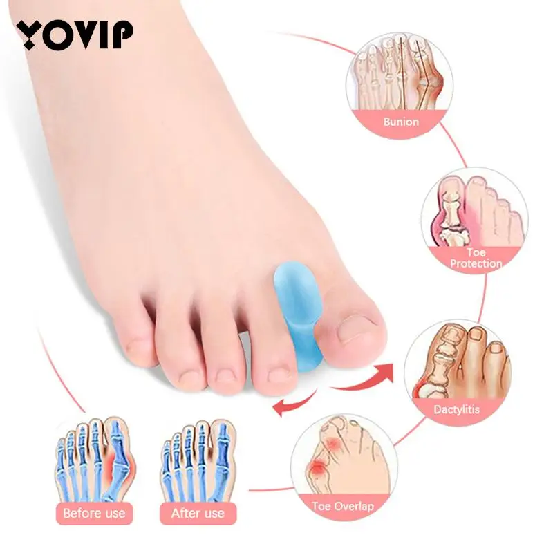 

1 Pair Children Adult Silicone Gel Toe Separators Orthotics Bunion Separators Toe Stretchers Correction Pad Foot Tool Care