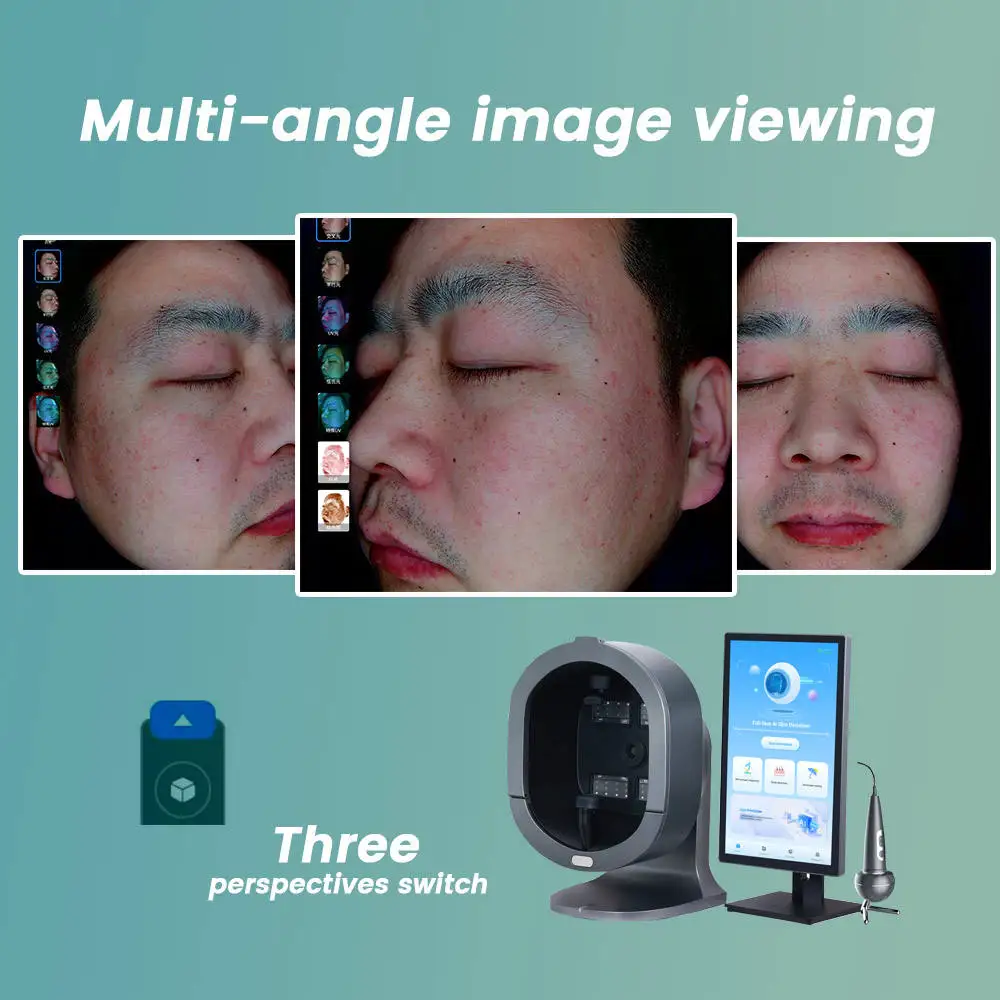 3D Facial Skin Analyzer Machine - Wrinkle Test Freckles Acne Scanner with Logo Customization for Skin Care And Beauty