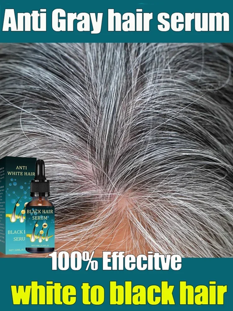 

White Hair Care - Grey hair essence Serum White hair essence quickly turns white air into black repairs natural