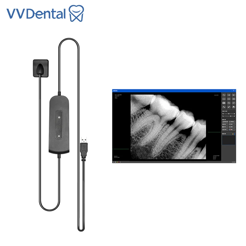 VVDental Dental Sensor X-ray Sensor Fast Transmission Digital Intraoral System Intra-Oral Include Software HD Image Dentistry