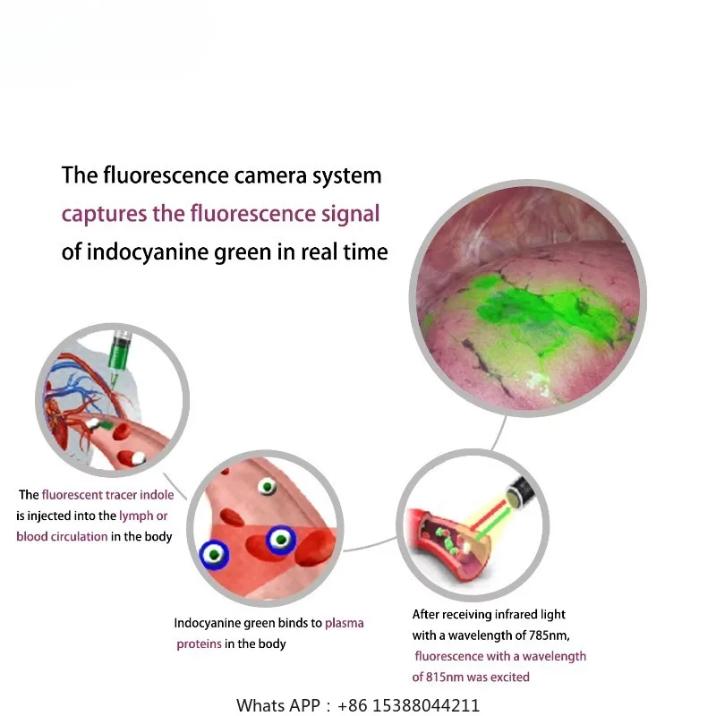 CE Approved 4K Medical Optical Rigid Endoscope Fluorescence Laparoscope For   Hysteroscopy ENT Surgery