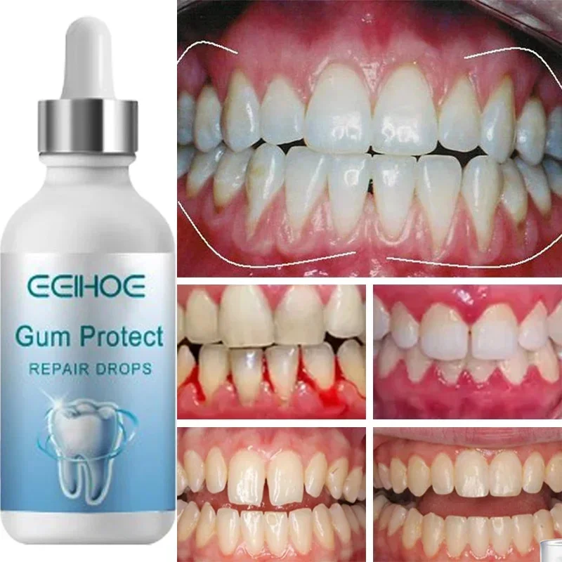 Rapid Repair Gums Serum Effectively Relieve Tooth Allergy Dental Caries Tooth Clean Toothpaste Relieve Tooth Damage Drops 30ml