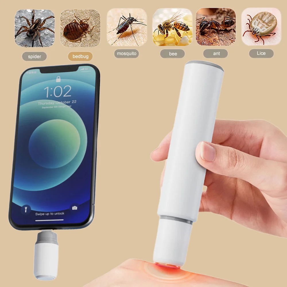 Bolígrafo antipicazón portátil, bolígrafo electrónico para picadura de mosquitos, bolígrafo para aliviar la picazón, para acampar al aire libre y viajar