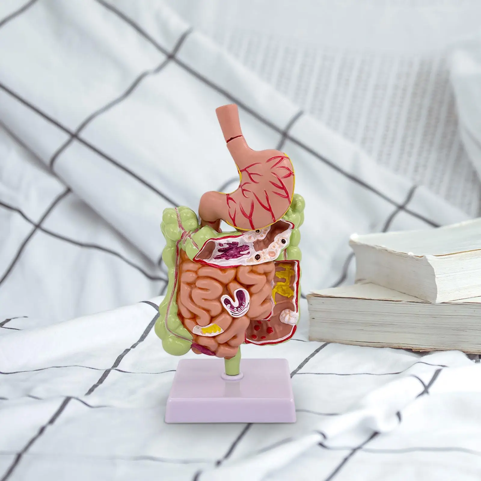 Human Stomach Anatomy Model PVC Pathological Digestive System Model for Study Display Education Office Classroom Demonstration