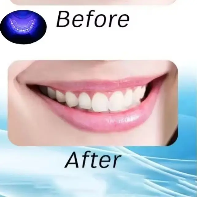 Oral Care Red Blue Light Therapy Device, for Immediate Tooth Pain Relief and Gum Sensitivity Treatment