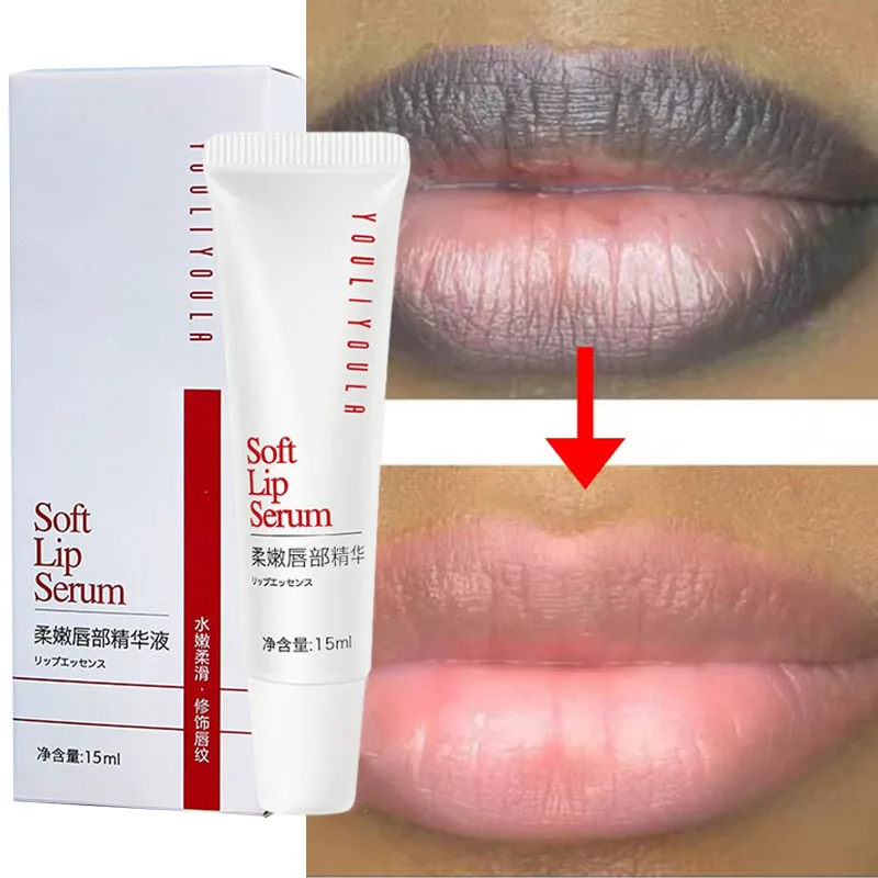 Entfernen dunkle Lippen Serum aufhellen Melanin Lippen maske Peeling verblassen Lippen linie abgestorbene Haut feuchtigkeit spendend aufhellen Reparatur Lippen pflege produkt