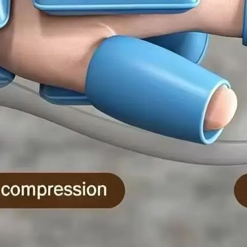 airbag-compression-hand-massager-electric-glove-portable-cordless-full-wrapped-fingers-palm-massage-device