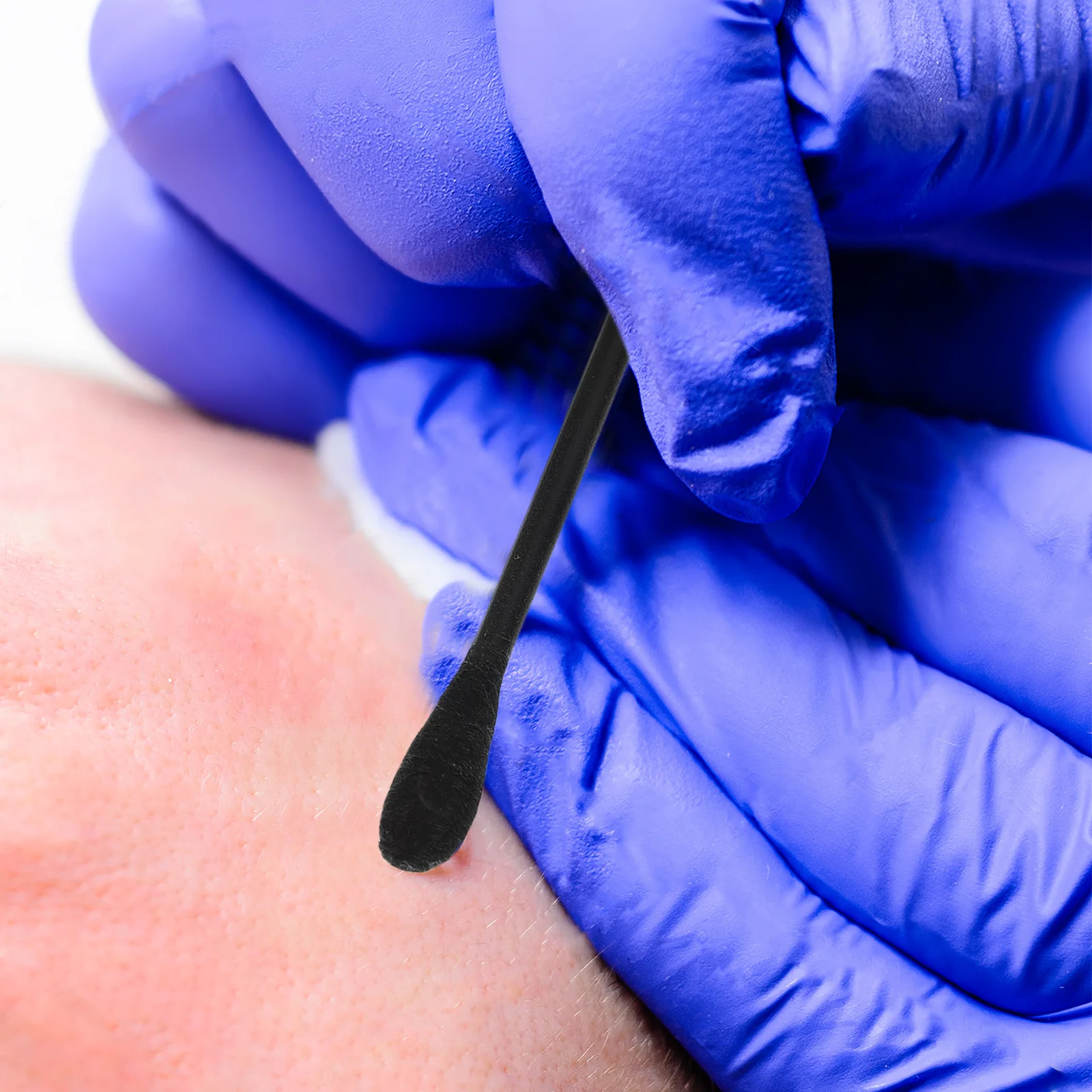 100 Stück Mitesser-Extraktor-Werkzeug, doppelseitiger Mitesser-Entfernungsstab für die Gesichtsporenreinigung, Tiefenreinigung, tragbare Schönheit