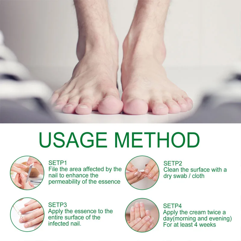 เอสเซนส์รักษาเชื้อราเล็บ 7 วัน น้ำมันหอมระเหยกำจัดเชื้อราเล็บเท้า ป้องกันการติดเชื้อ รักษาเล็บขบและเล็บอักเสบ