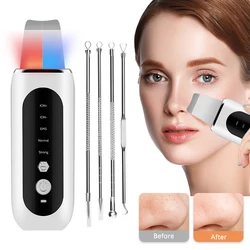 Ultrasonic Face Skin Scrubber, Skin Shoveling, EMS Micro-Current, Import Ion, Facial Skin Lift, Pore Clean, Luz vermelha e azul, Ferramenta de beleza