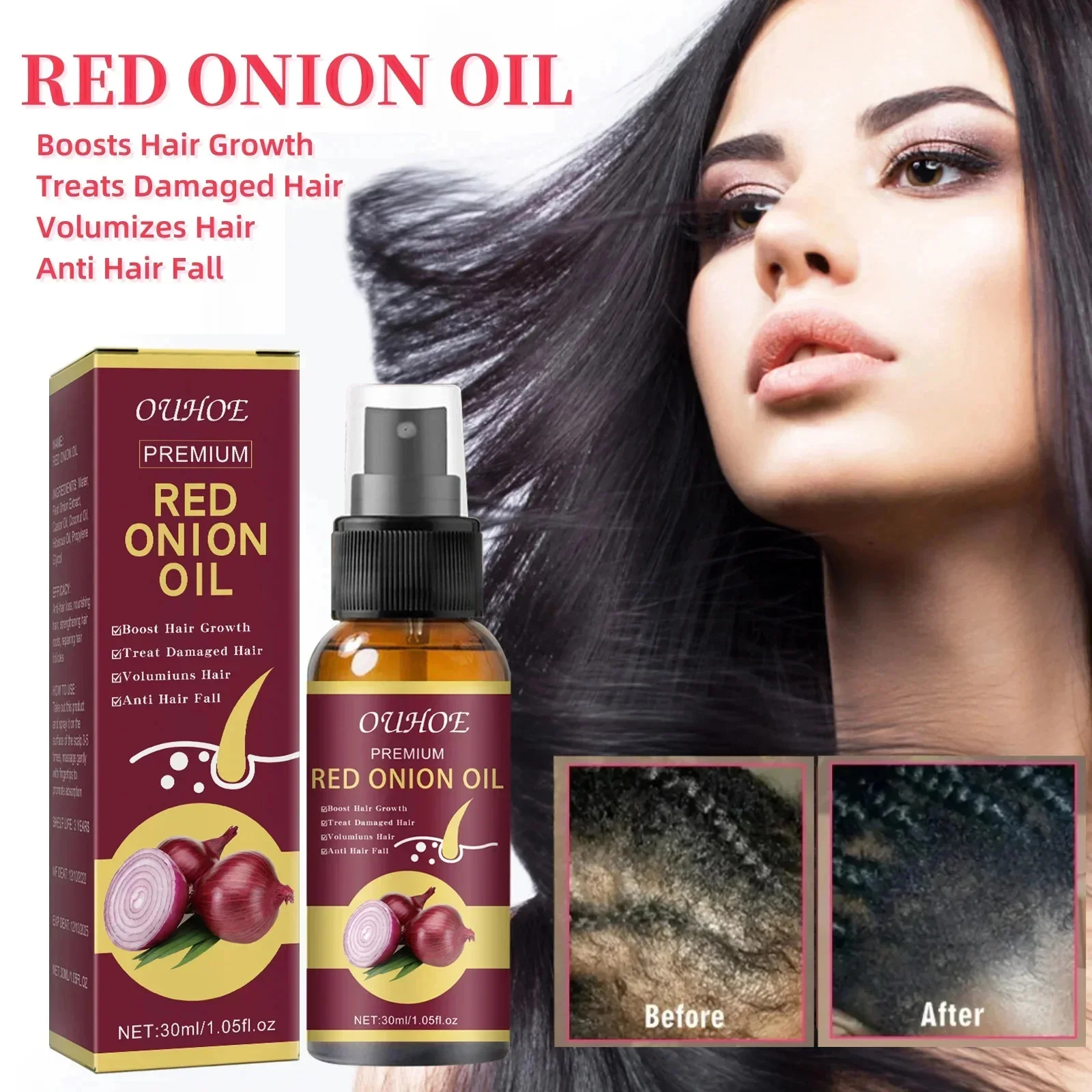 Hair Growth Serum Spray Fast Growing Hair Essential Oil Anti Hair Loss Treatment Products Repair Hair Nourish Root For Men Women