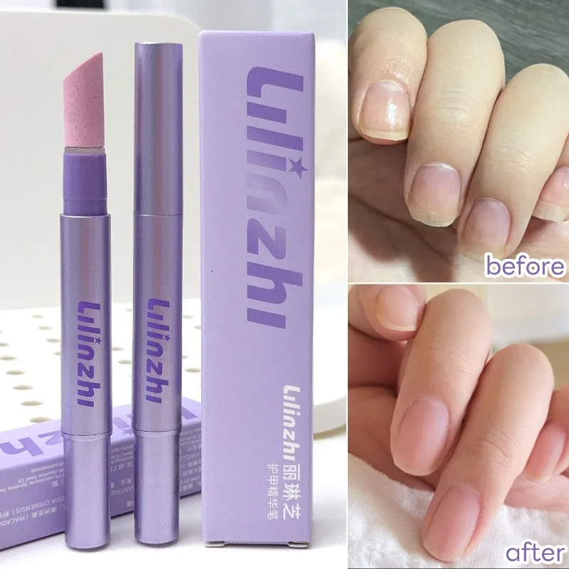 3-in-1 Moisturizing Keratin Nail Pen Exfoliating Barbed Nails Polishing Essence Oil Pen Brush Dead Skin Remover Nail Care Tools