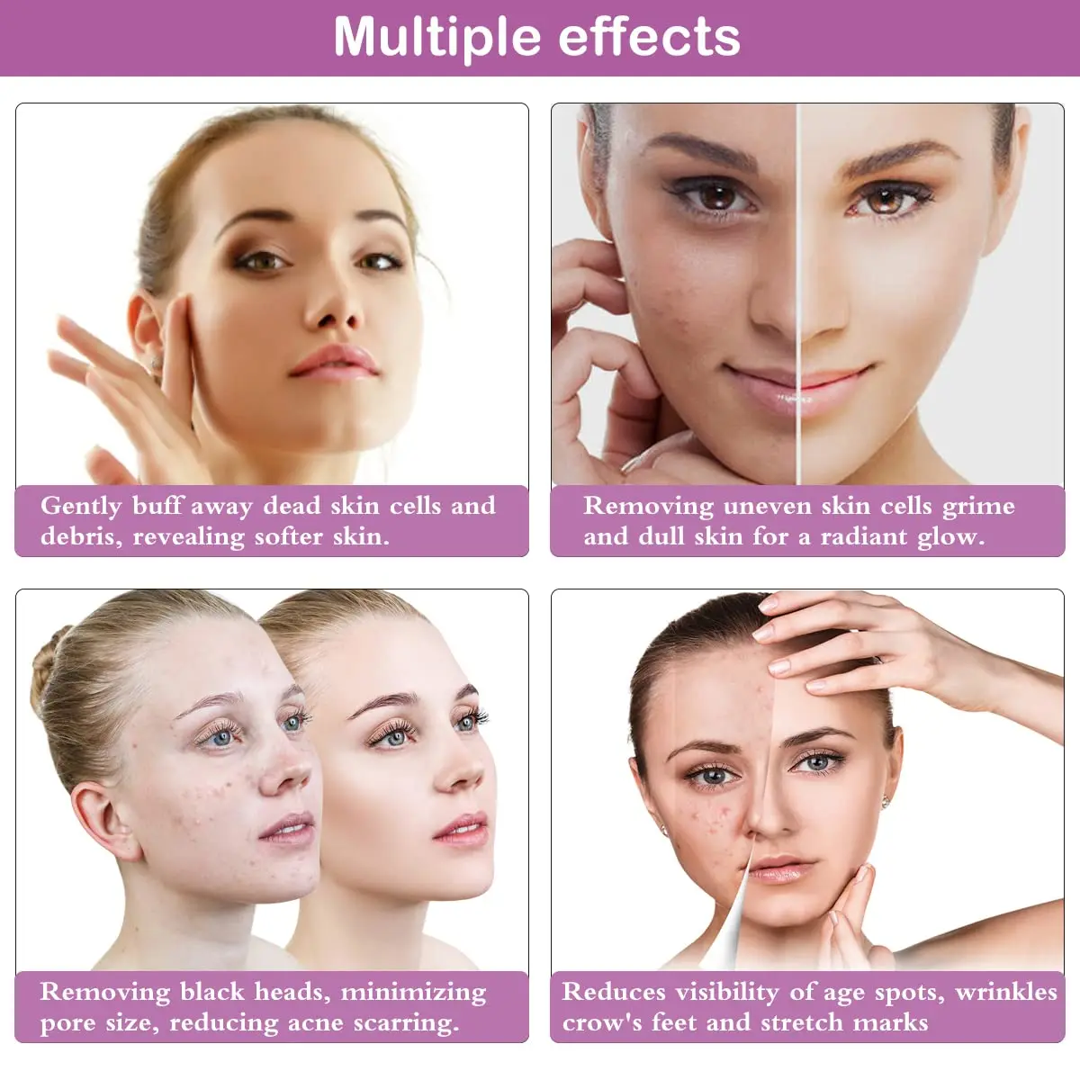 Diamond Microdermabrasion Machine Dermabrasion Blackhead Extraction Water Spray Exfoliation Beauty Wrinkle Face Peeling Machine