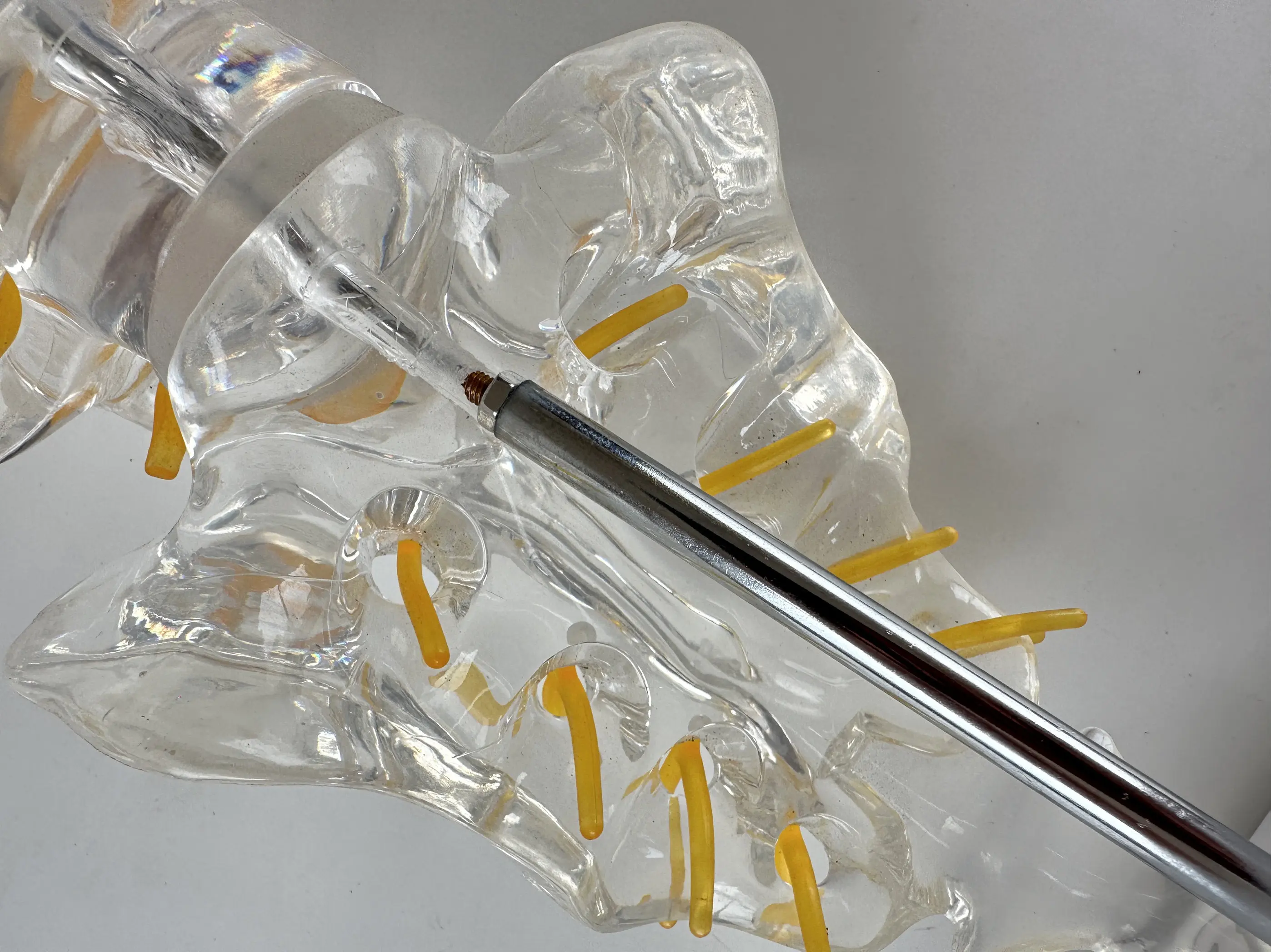 Transparent Lumbar Spine Model with Tailbone, Intervertebral Disc, Spinal Nerve, Sacrum for Orthopedic 3D Teaching