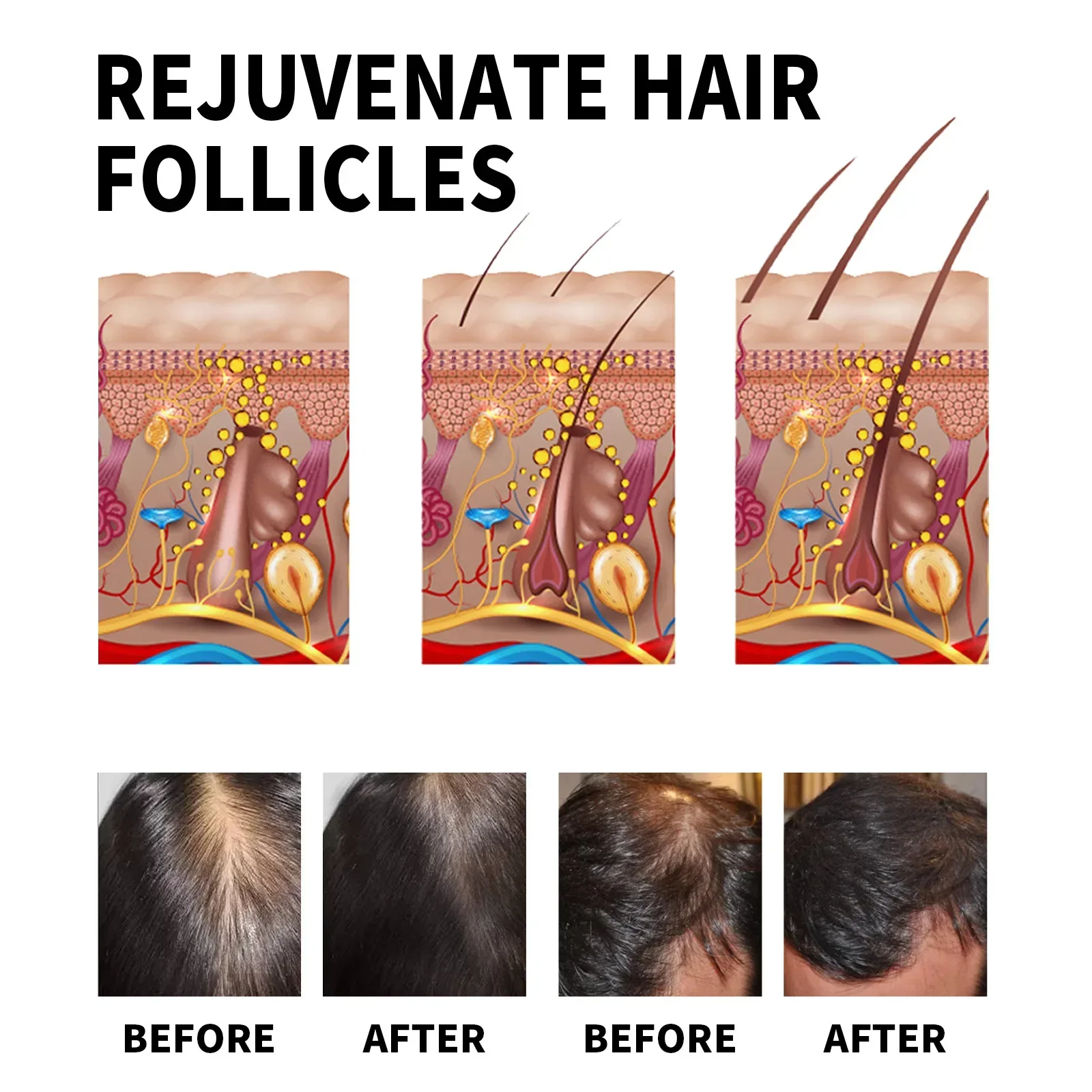 Thumbnail 4 - #15 Latest Hair Loss Treatments Offers