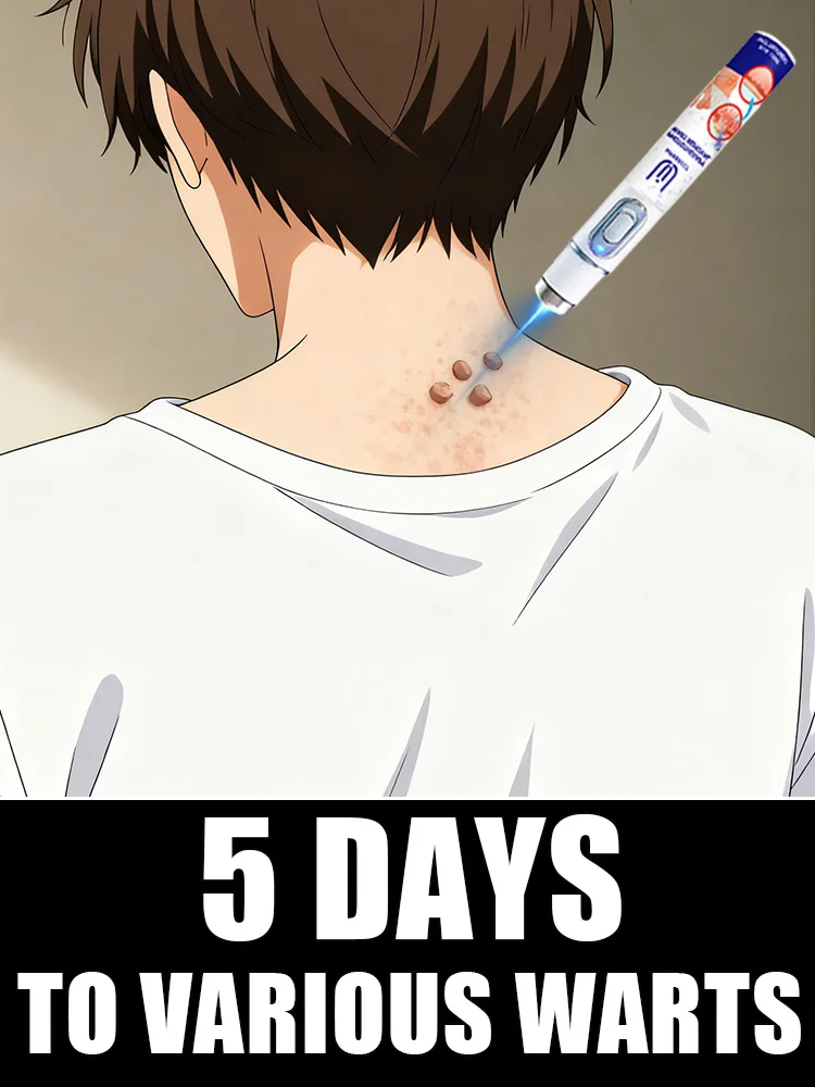 

2nd ᵍᵉⁿᵉʳᵃᵗⁱᵒⁿ ᵘᵖᵍʳᵃᵈᵉᵈ wᵃʳᵗ ⸴ ʳᵉpᵃⁱʳ wᵃʳᵗˢ ʳᵒoᵗ ⸴ ᑫᵘⁱᶜᵏˡʸ