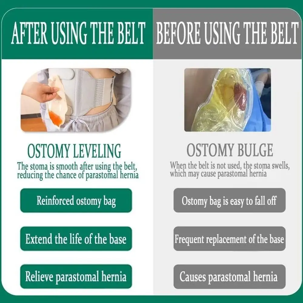 

Универсальный регулируемый пояс для стомы, портативный дышащий пояс для поддержки стомы, эластичный поясной ремень для живота
