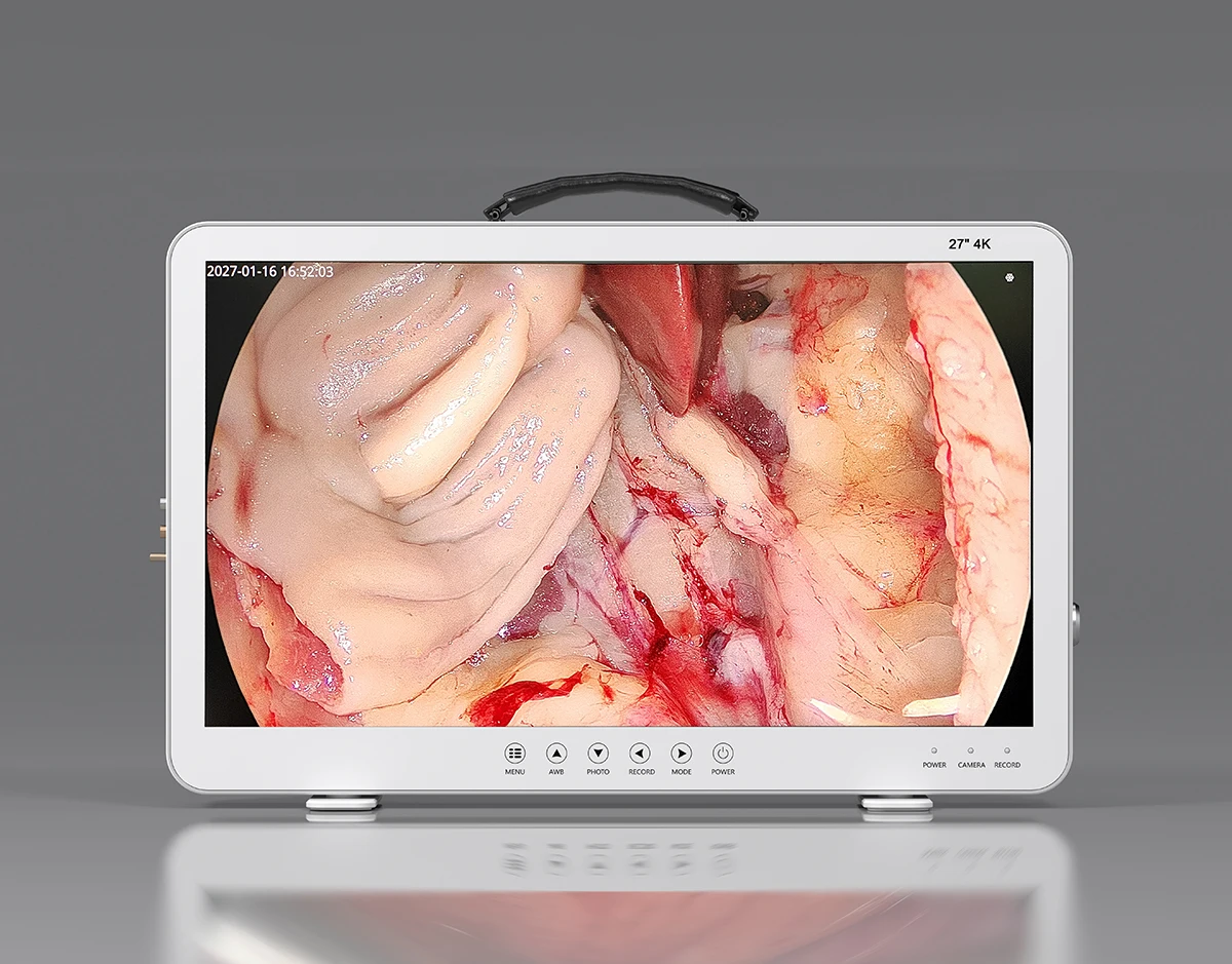 4K Ultra 27 Inch Monitor Laparoscopic Camera UHD Medical Endoscope System with HDMI Input