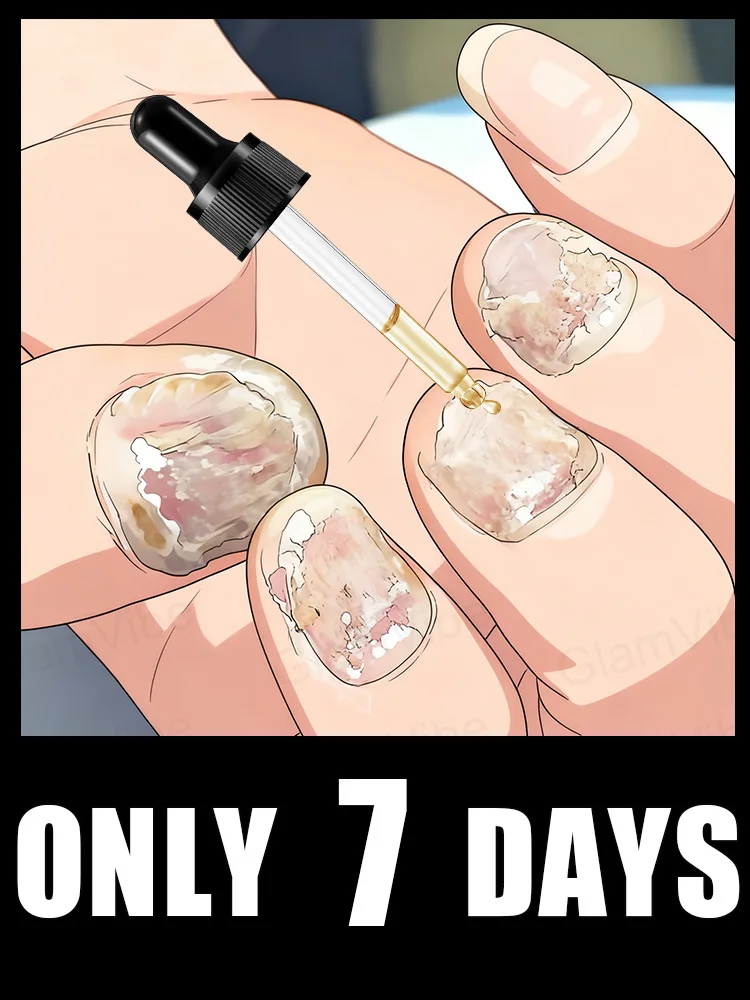 Narzędzia do czyszczenia paznokci i naprawy korzeni paznokci, popularne w 2025 roku, ulepszone do drugiej generacji.