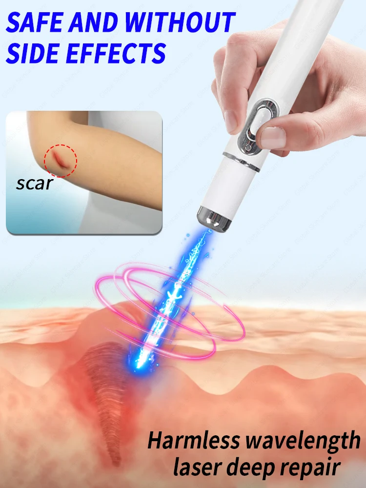 Hot Selling Laser Scar Repair Keloids.