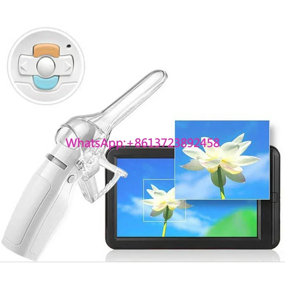 MY-F005A Portable  colposcopio digital goldway wireless video camara  precio usb colposcope for gynecology