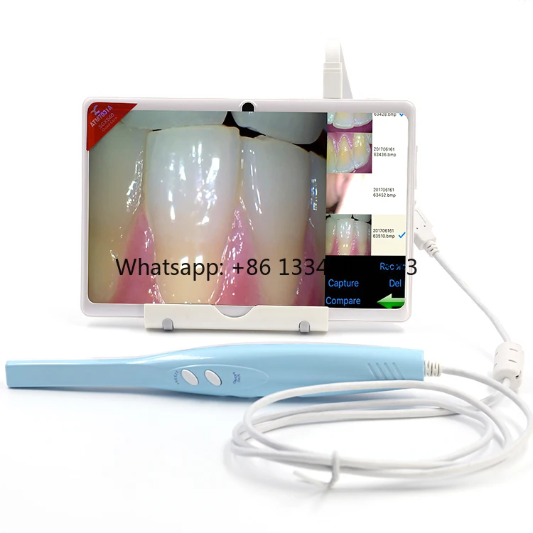 

Wholesale 2025 New Trending Product Unit Implants USB Cable 5 Mega Intra Oral for Dentist Fast delivery