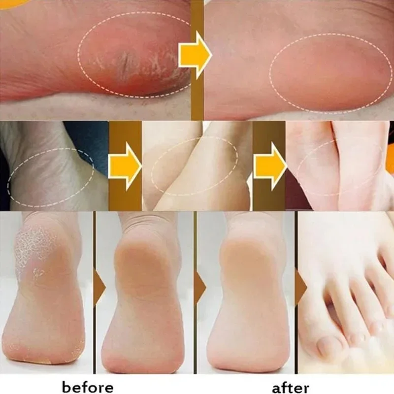 30g Moisturizing Anti-Drying Crack Foot Cream Hand Feet Care Family Exfoliation Dead Skin Removal Softening Smooth Skin Cream