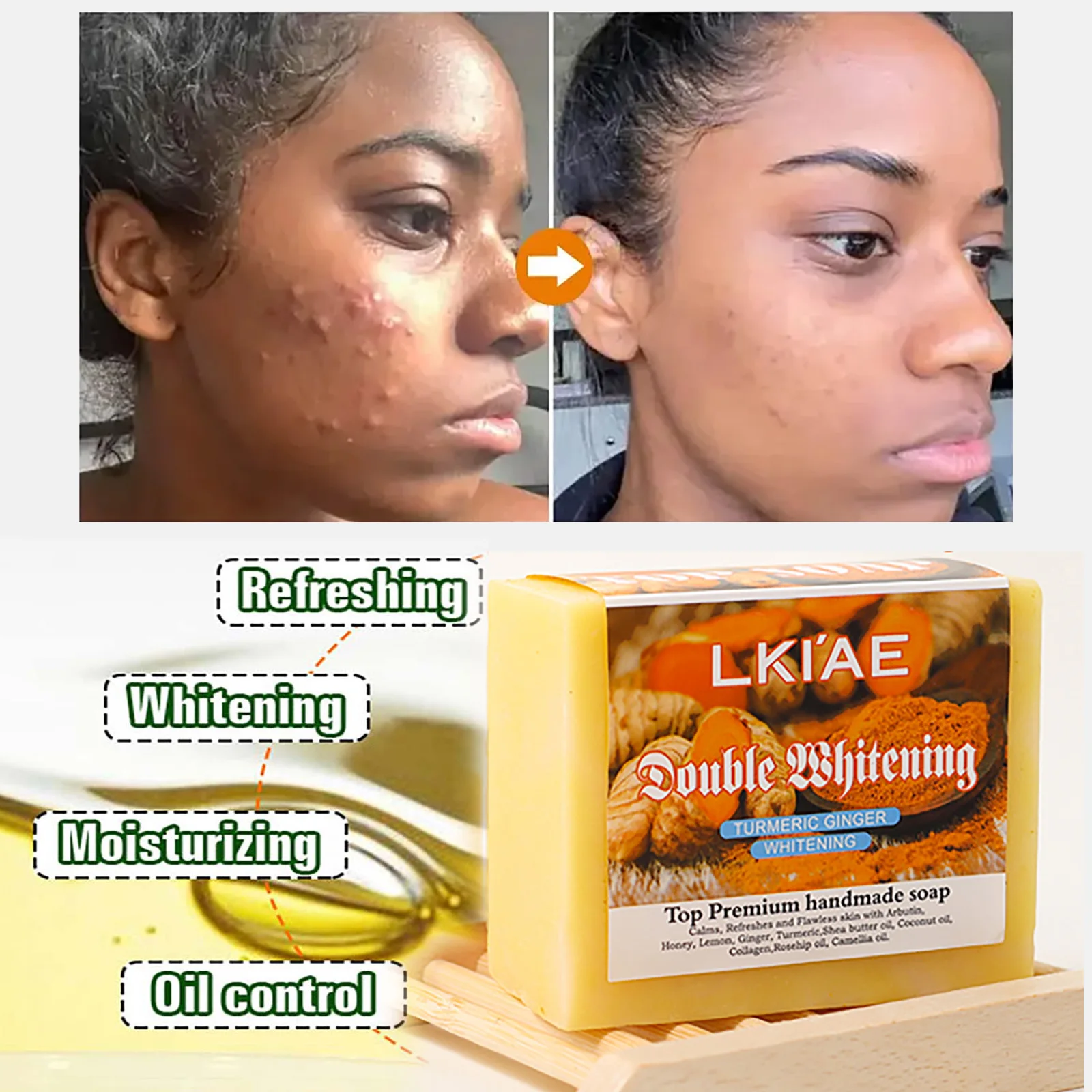 

Отбеливающее мыло с натуральной куркумой, уменьшает прыщи, пятна, увлажнение и разглаживание кожи, с медом, глицерином, 150 г/5,3 унции