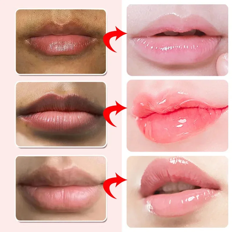 Lip Balm Remove Dark Lip Moisturizing Lightening Melanin Whitening Plumper Extreme Gloss Pink Lips Skin Care For Men Women