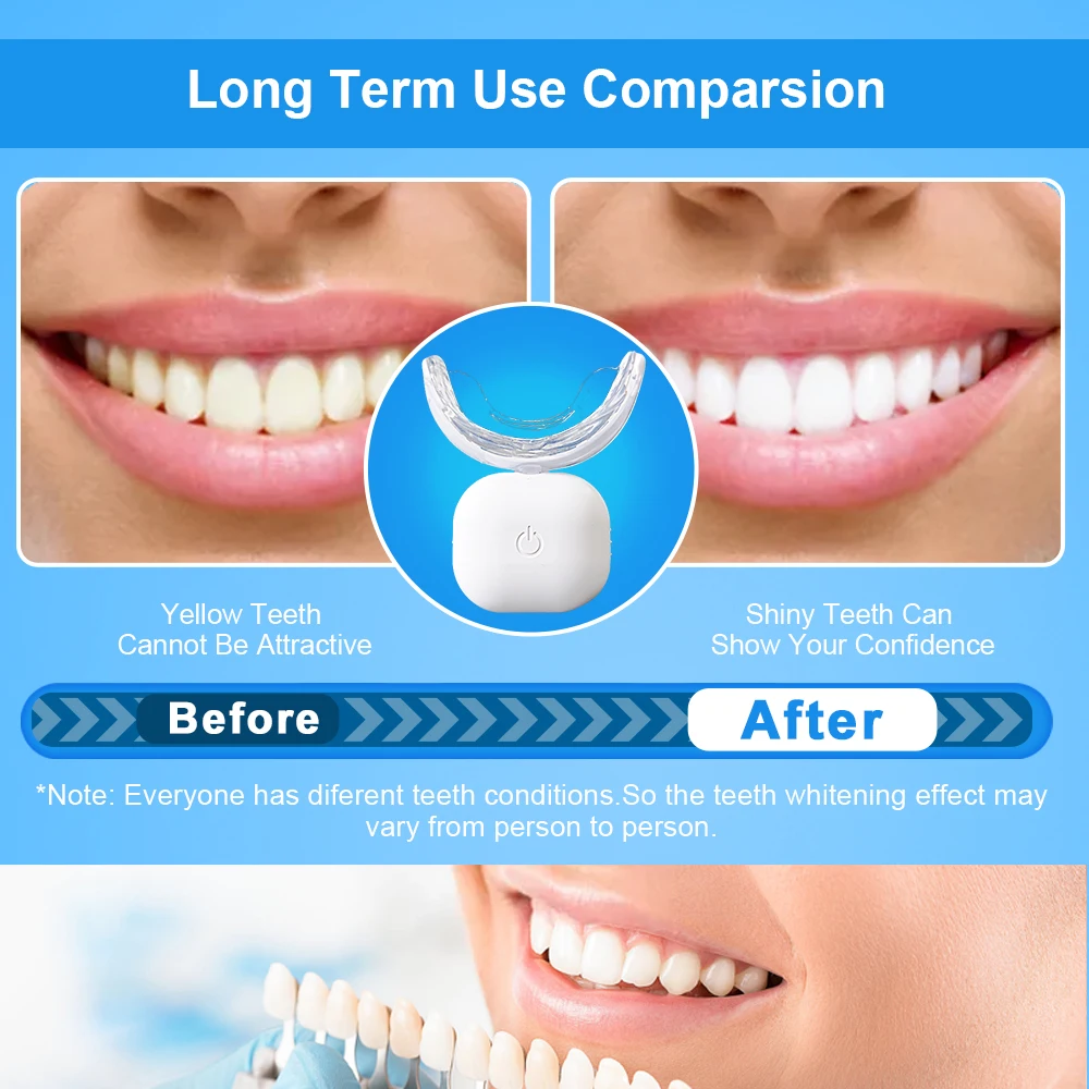 Teeth Whitening LED Light With Gel Pen Combination 32 LED Blue Red Lights Wireless Rechargeable 7 Days Whiten Tooth Home Use