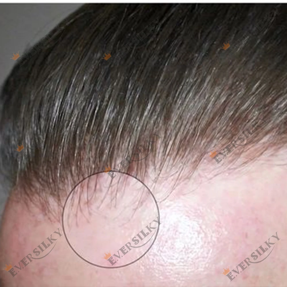 

80% Density Invisible Realistic 0.02mm Ultra Thin Skin Prosthesis Brown Gray 1B20 1b50 Human Hair System Undetectable Men Toupee