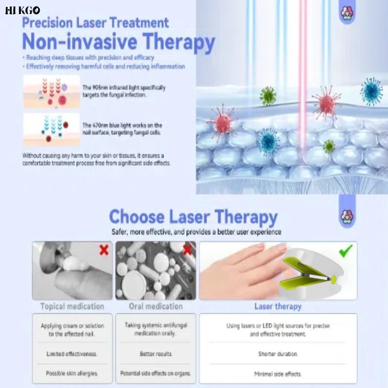 

Лазерная система удаления грибка ногтей 905 нм, клинически эффективная обработка ногтей на ногах, безопасное домашнее устройство для ухода за здоровьем