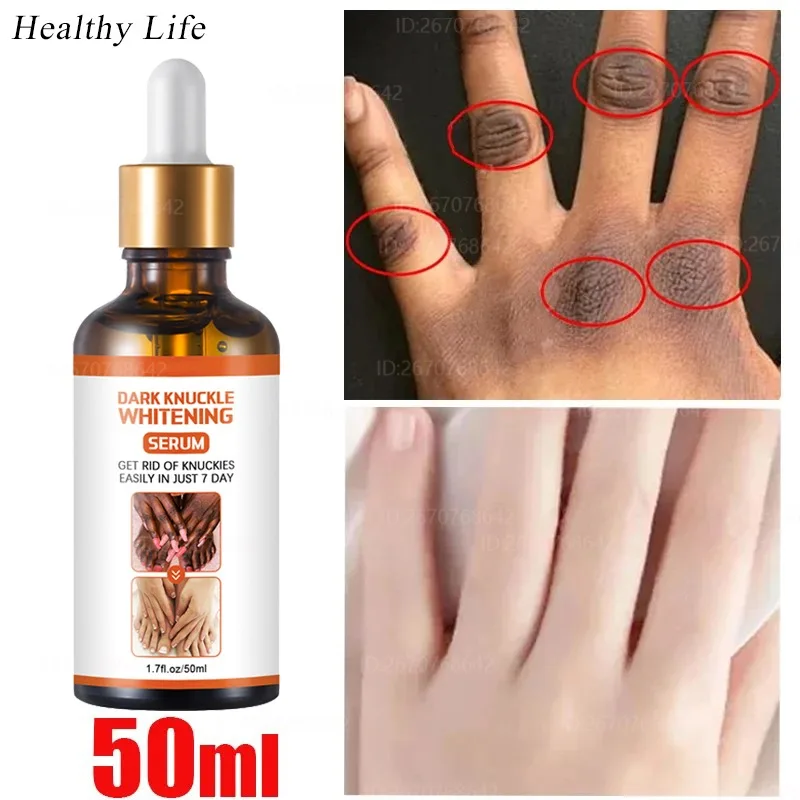 

Dark Knuckles Fast Whitening Serum Hand Knuckle Removal Melanin Essence Elbows Knee Stains Remover Products Brightening Care