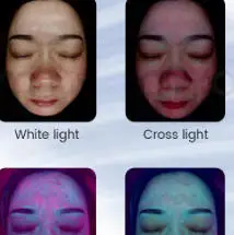 

21.5 Inch X5 Facial Skin Analyzer 3D AI Hair Analysis 8 Light Spectrum Scanner For Professional Beauty Business