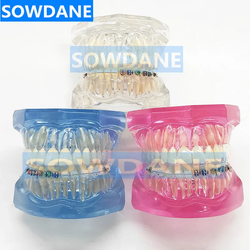 New Dental Orthodontic Tooth Model for Patient Communication Dental Study Teeth Model with Invisible Transparent Crown Bracket