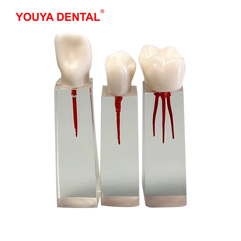 6 adet restorasyon diş eğitim modeli endodonti kök kanal blok reçine Endo diş modeli eğitim uygulama hamuru boşluğu RCT