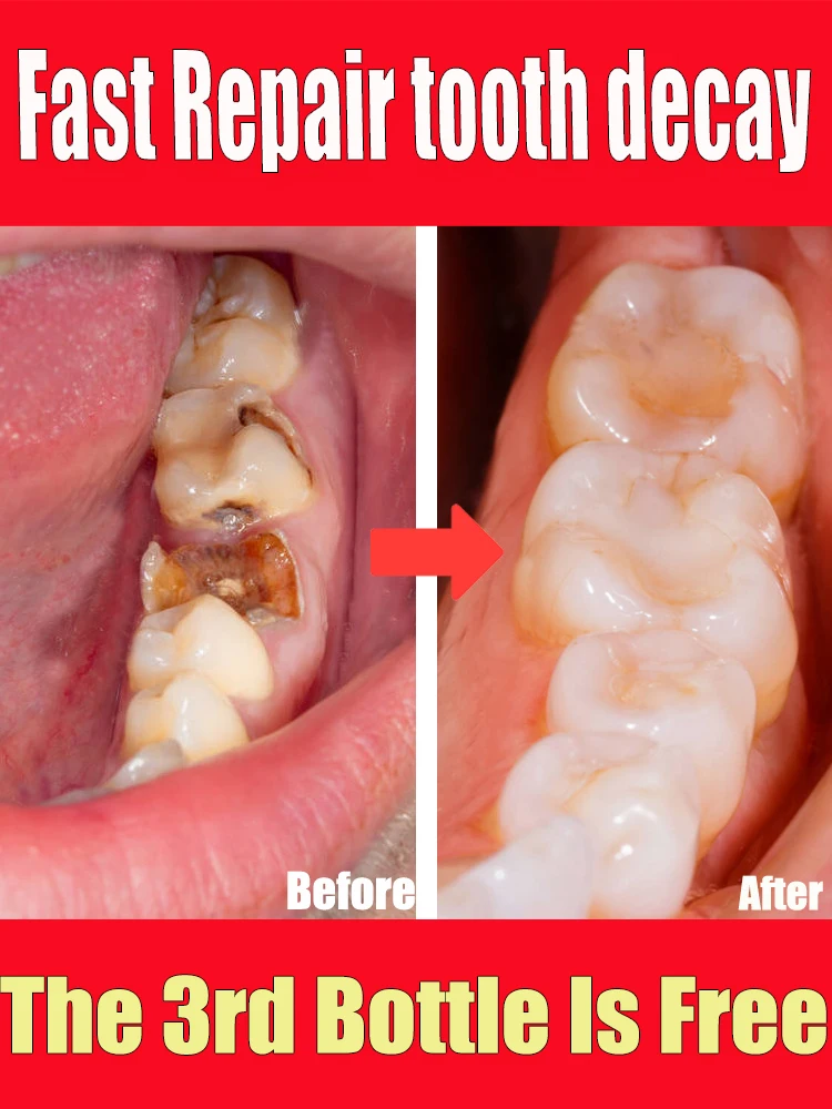 tooth decay repair cavities protect teeth