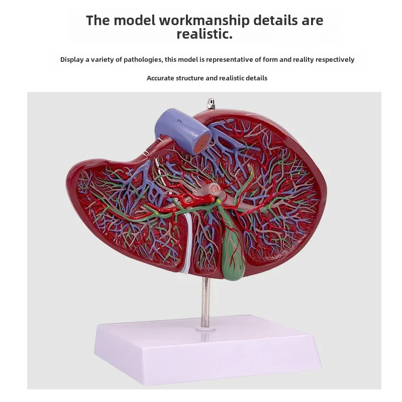 High-depth Simulation Liver Model Dissection Model Liver Gallbladder Pancreas Twelve-digit Tendon Floating Disease Gallbladder