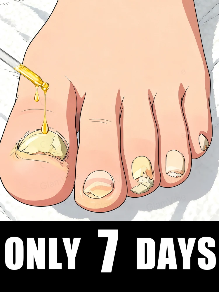 

Qᴜɪᴄᴋʟʏ ᴇʟɪᴍɪɴᴀᴛᴇ ғᴜɴɢᴜs ᴀɴᴅ ʀᴇsᴛᴏʀᴇ ʜᴇᴀʟᴛʜʏ ɴᴀɪʟs