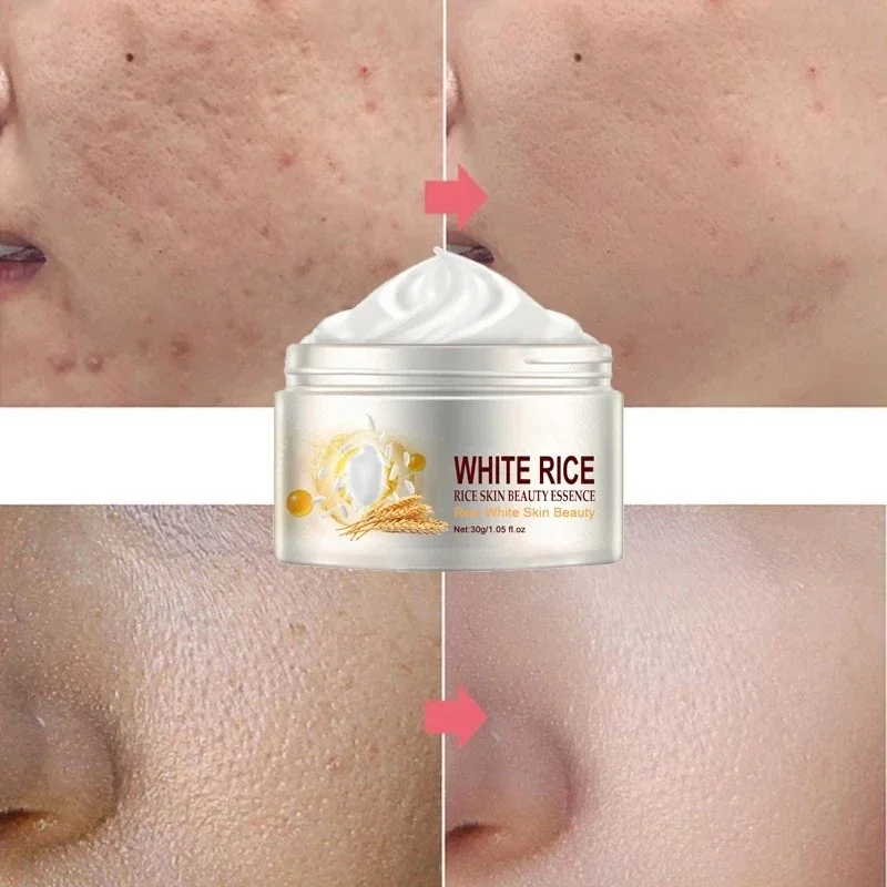 Korean White Rice Whitening Face Cream Anti Aging Remove Wrinkles Dark Spots Bleaching Melanin Improve Dull Moisturize Skin Care