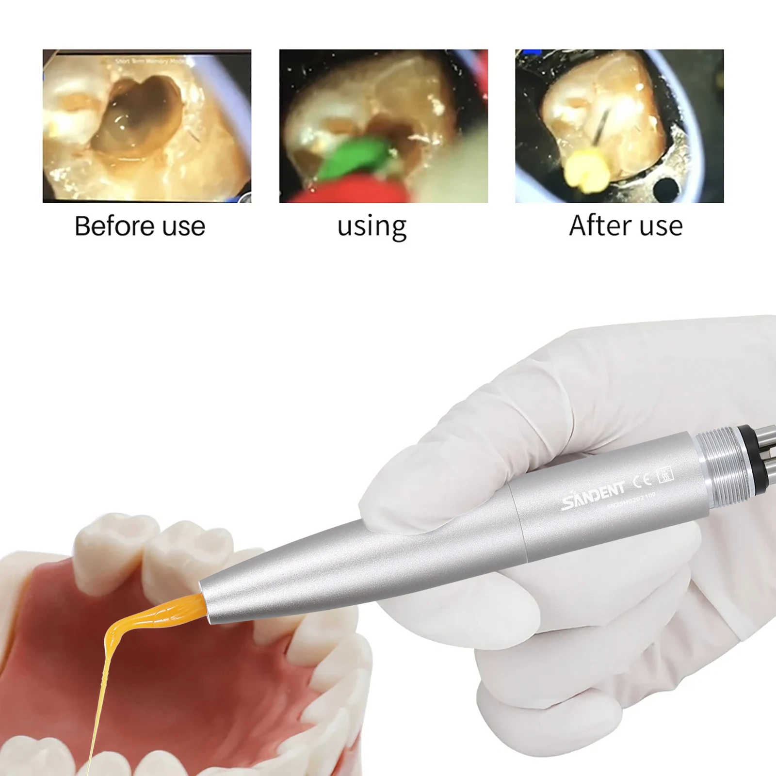 

Dental Ultrasonic Activation Irrigation Scaling 4holes Handpiece Air Scaler + 3pcs Plastic Tips