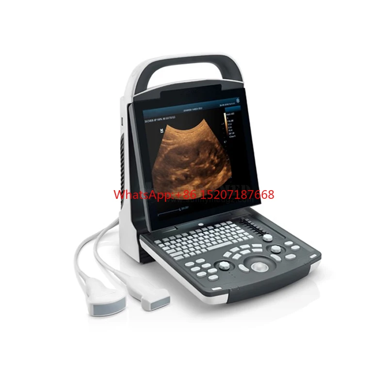 High Quality Medical Ultrasound Machine Mindray DP-20 Potable Digital Ultrasound Device for Abdomen, OB, GYN, Cardiology