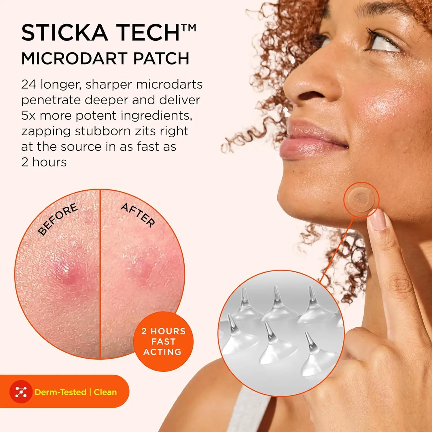 9/18 Pcs Hydrocolloid pimple patches - Absorb Pus & Oil, Reduce Redness, Invisible Fit for All-Day Wear .