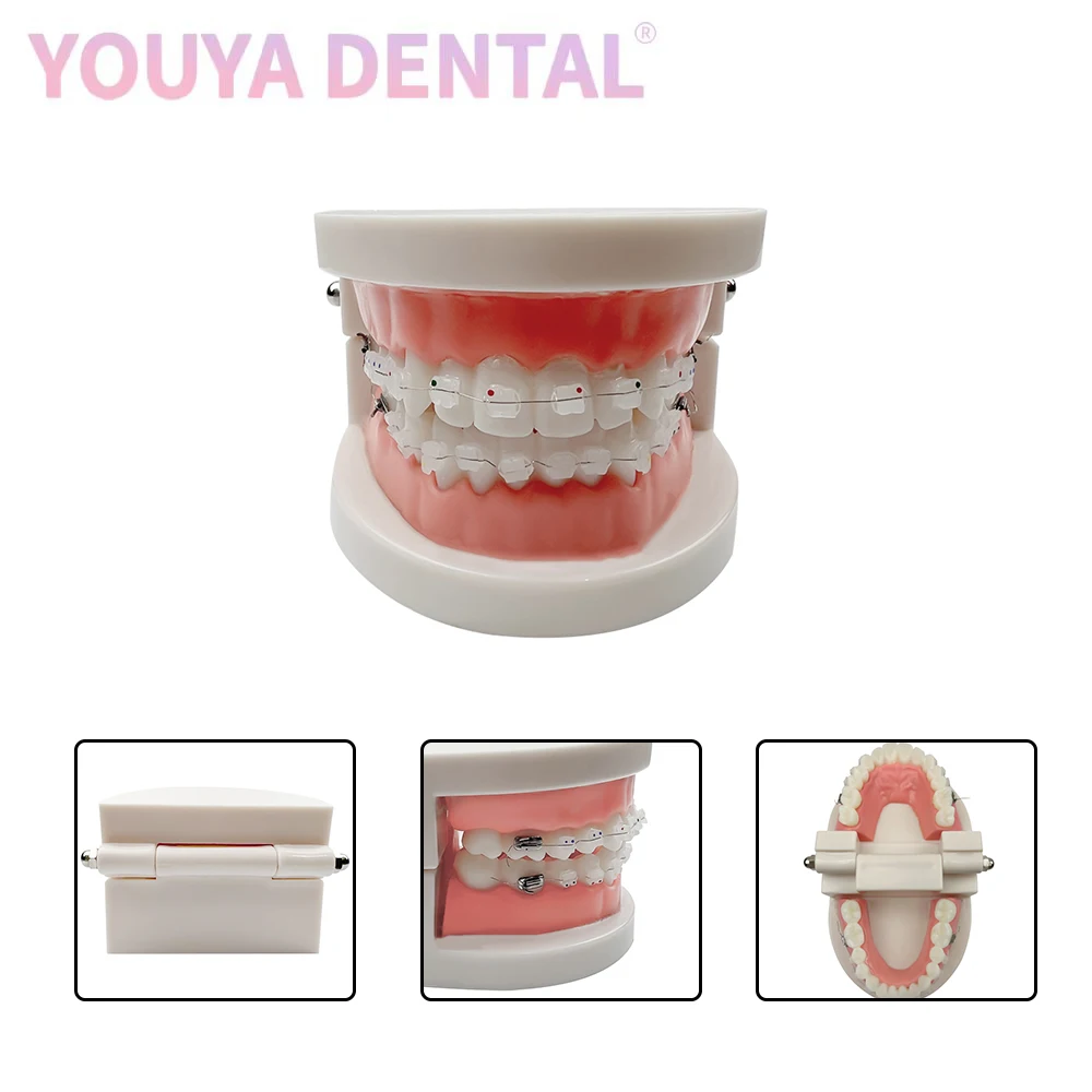 1pc 28-Teeth Standard Tooth Model Orthodontic Tooth Model With Metal Self-Ligating Brackets Ceramic Bracket Teaching Tooth Model