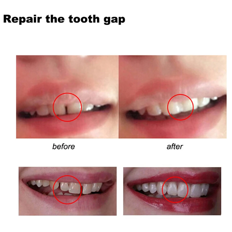 Temporary Tooth Repair Kit Teeth Gaps Falseteeth Solid Glue Denture Adhesive